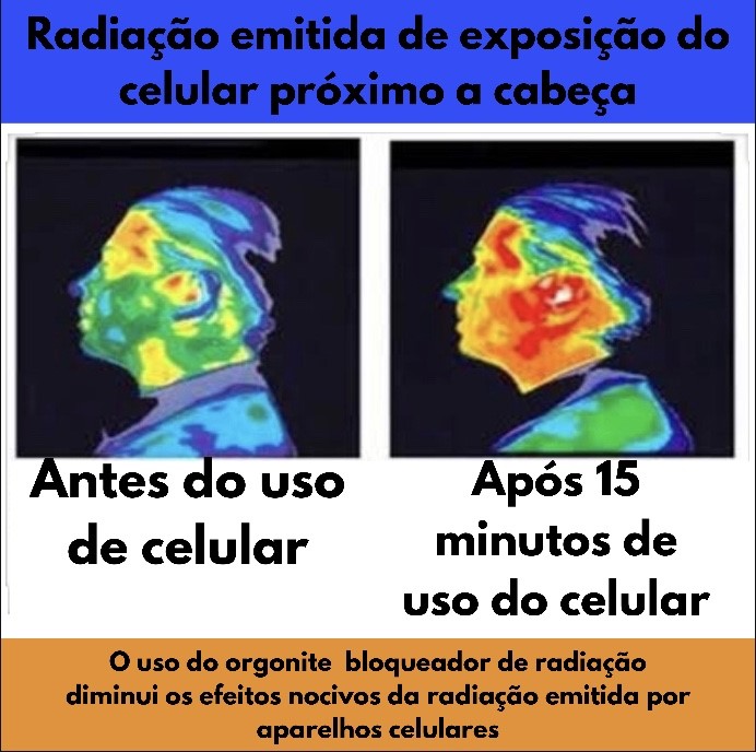 Radiação emitida de exposição do celular próximo a cabeça